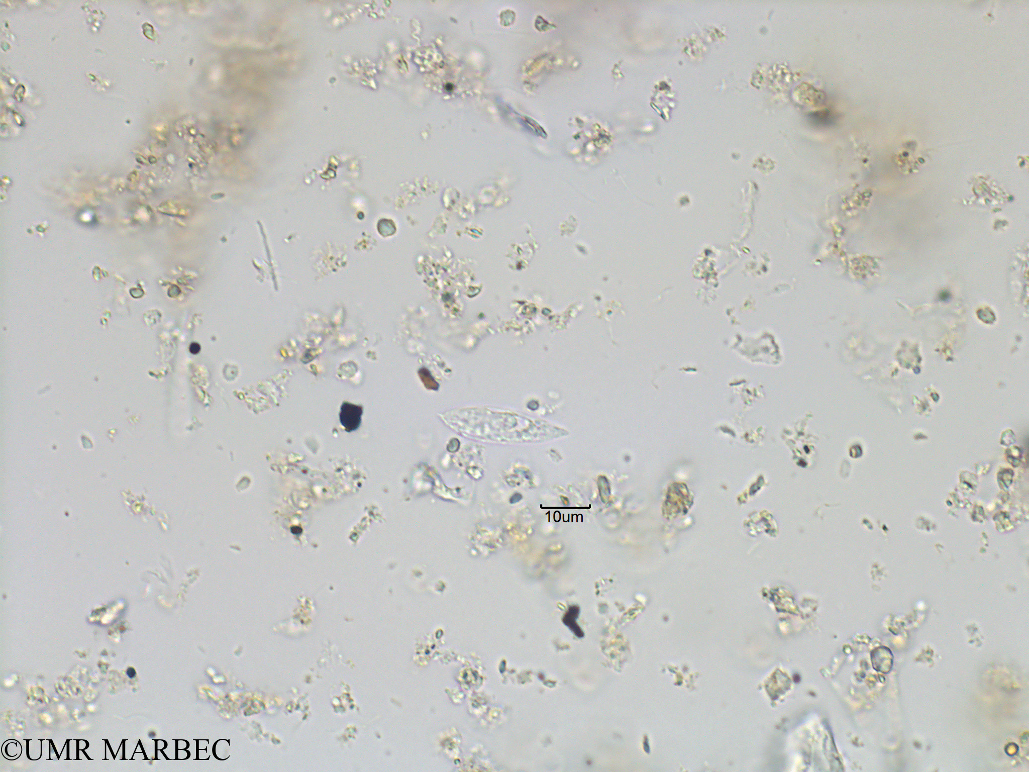 phyto/Bizerte/bizerte_bay/RISCO November 2015/Lessardia elongata (Baie_T1C-cf gyrodinium-3).tif(copy).jpg
